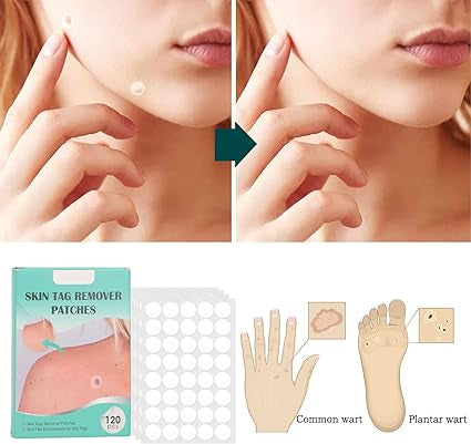 Parches Eliminación de Lunares