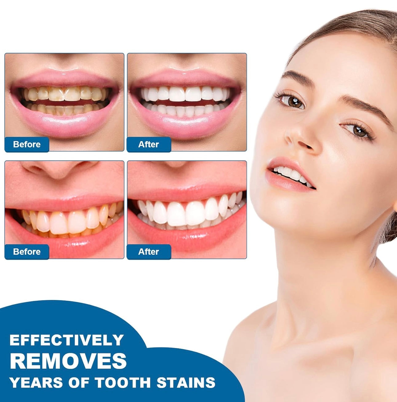 Lápiz blanqueador de dientes